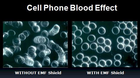 مقایسه سلول‌های خونی در حالت استفاده از EMF Shield و عدم استفاده از آن