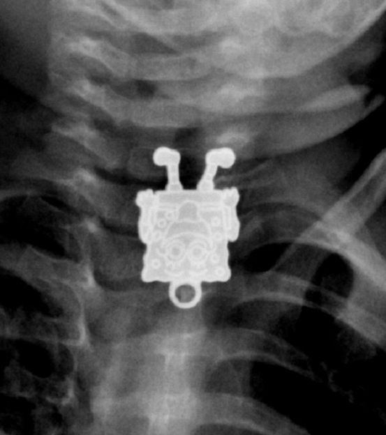 spongebob-x-ray