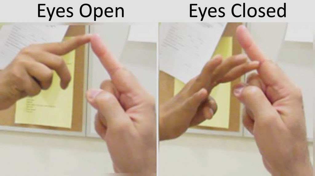 همانطور که مشاهده می‌کنید بیمارانی که در ژن PIEZO2 دجار جهش شده‌اند در تشخیص موضع لمس با چشمان بسته مشکل دارند. منبع: NIH