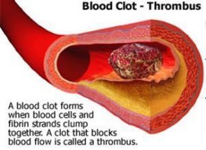 blood_clotting (4)