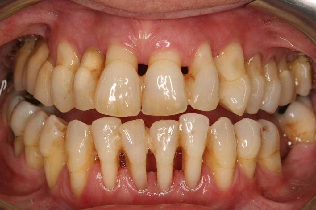 periodontitis-virtualdr.ir