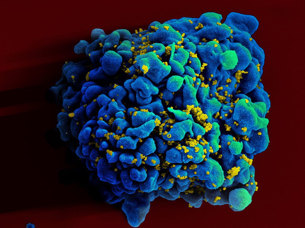 scientists-have-discovered-how-get-immune-t-cells-locate-destroy-mutated-hiv-virtualdr.ir