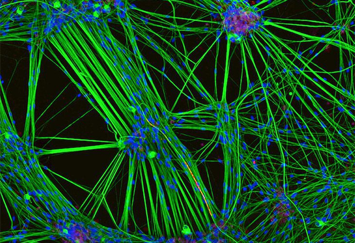 Brain Game - رتبه سوم مسابقات: این سلول‌های عصبی (سبز‌رنگ) متعلق به بافت پوست انسانی هستند که در آزمایشگاه کشت داده شده‌اند. سلول‌های شوان (سلول‌های گلیال محیطی) نیز به رنگ قزمر نشان داده شده است. این تصویر نمایان‌گر شبکۀ ارتباطی بسیار پیچیدۀ عصبی در مغز است. بزرگ‌نمایی 20x