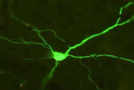تصویر مربوط به نورونی از قشر مغز است که در حال بیان پروتئین گیرنده‌ی سبز رنگی (با فلوئورسنت) می‌باشد. این مورد مربوط به بیان موفق گیرنده‌ی DREADD است. (اعتبار تصویر متعلق به David J. Bucci، کالج کالج دارتموث می‌باشد.)