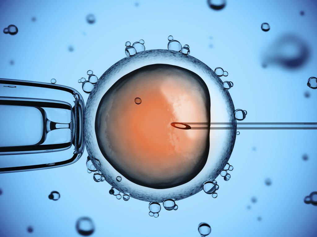 تزریق اسپرم به داخل سیتوپلاسم تخمک.