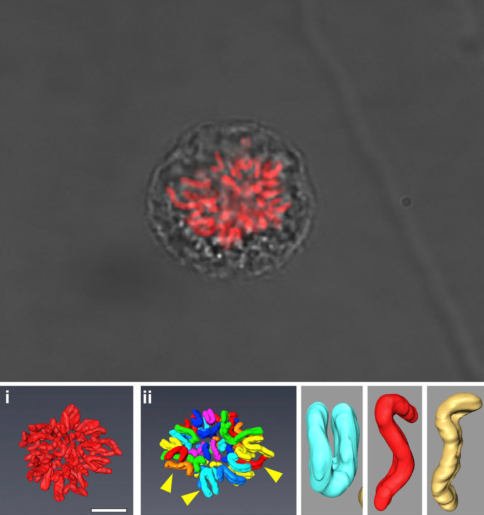 بالا: سلولی متعلق به بافت پوششی رنگی شبکیه (Retinal Pigment Epithelium). پایین: تصویر i محتوای کامل کروموزومی و تصویر ii همان محتوا را به صورت سگمنتال نشان می‌دهد. کروموزوم‌هایی که در تصویر ii با فلش مشخص شده‌اند در سمت راست نیز بزرگنمایی شده‌اند که شامل کروموزوم متاسنتریک (فیروزه‌ای) و دو کروموزوم ساب‌متاسنتریک (قرمز/نارنجی) می‌باشد. منبع: Sci-News