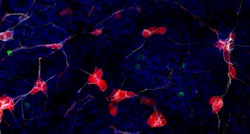 محققان با استفاده از روش CLARITY، تجمعات آلفا-سینوکلئین را در دستگاه گوارش ردیابی کردند (سبز) که سلول‌های عصبی (قرمز) و آستروسیت‌ها (سفید) را نیز درگیر کرده بود.