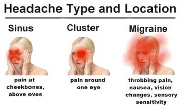 headaches-types-virtualdr
