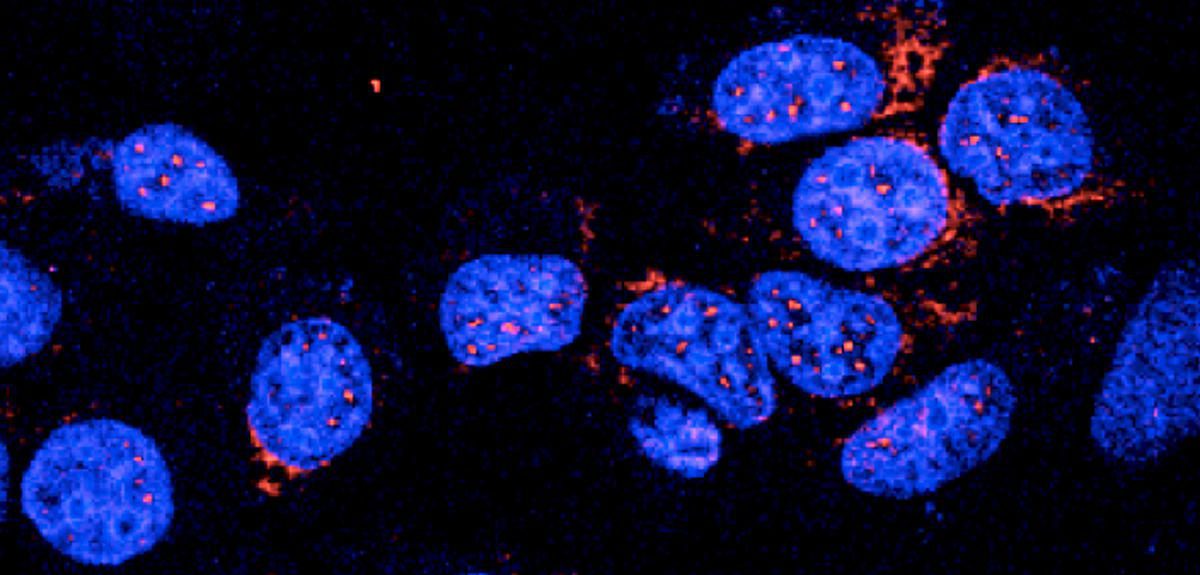 DNAهای چهاررشته‌ای‌‌ (قرمز) در هسته‌ی سلول انسانیِ فیکس شده (آبی)