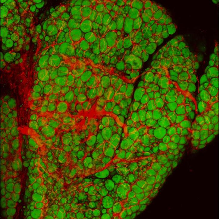 بافت چربی، قطرات چربی (سبز) و عروق خونی (قرمز) اعتبار تصویر متعلق به آزمایشگاه Zoltan Arany محقق همین مطالع در داشگاه پنسیبوانیا می‌باشد.