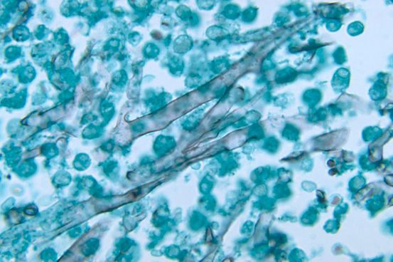 mucor pusillus اعتبار تصویر متعلق به CDC است.