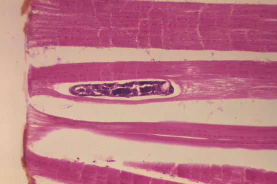 onchocerca volvulus اعتبار تصویر متعلق به CDC است.