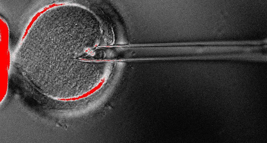 Spindle Swap نوزاد پسری که در آوریل ۲۰۱۶ متولد شد محتوای ژنتیکی خود را از پدر و مادر و محتوای میتوکندریایی‌اش را از یک اهداکنندۀ زن دریافت نموده است. جهت ایجاد سلول تخم سه‌والده، DNA مادری از طریق نوعی سوزن خارج شده و به تخمک اهدایی - که DNAاس تخلیه شده است - تزریق می‌شود. منبع: Science News