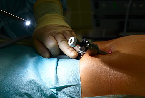 getty_rf_photo_of_laparascopic_surgery_preparation