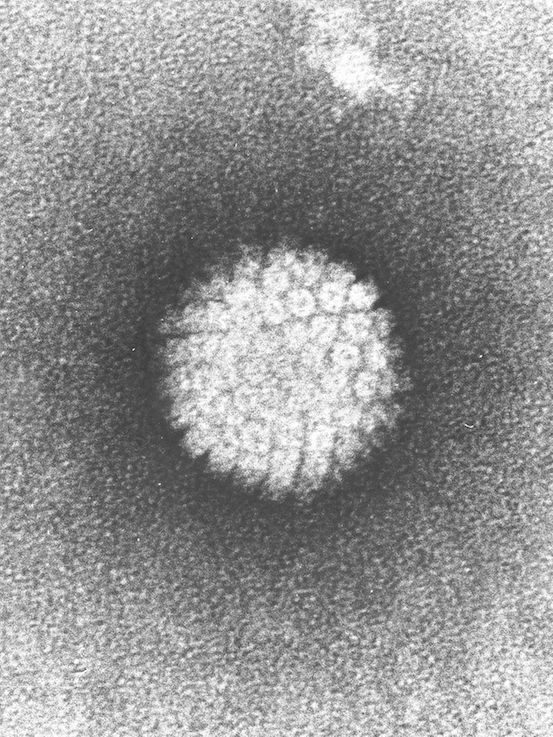 ویروس HPV؛ اعتبار تصویر متعلق به Laboratory of Tumor Virus Biology می‌باشد.