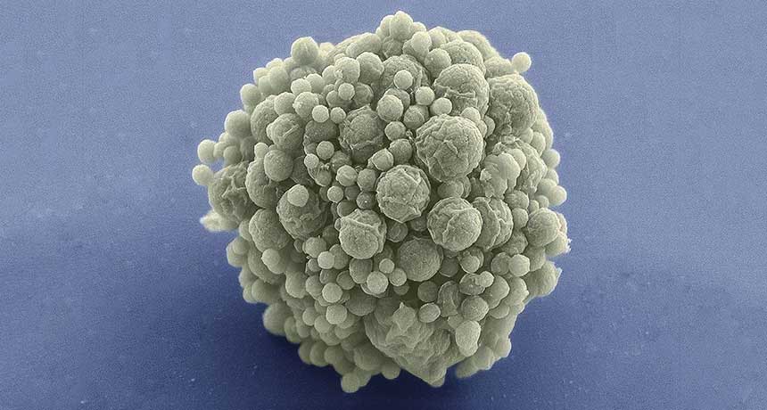 Most Minuscule این باکتری مهندسی‌شده با نام syn3.0 توانست است صرفاً با داشتن ۴۷۳ ژن - باکتری E. coli در حدود ۴۶۰۰ ژن دارد - زنده بماند. منبع: Science News
