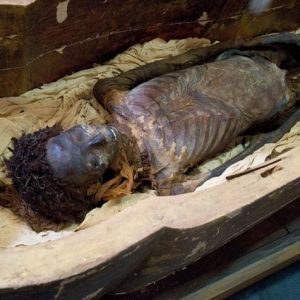 mummy-scan