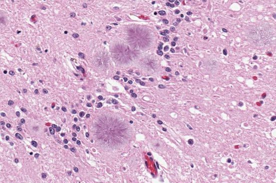 پریون‌ها؛ اعتبار تصویر متعلق به CDC است.