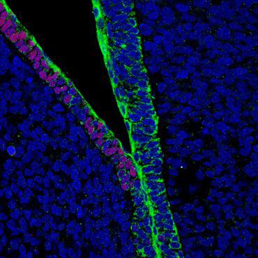 Touch of Human سلول‌های انسانی تزریق شده به رویان خوک (سبز) توانستند به سلول‌های دیگری مانند سلول‌های مخاط روده (قرمز) تمایز یابند. تصویر متعلق به رویان ۴ هفتگی خوک می‌باشد. DNA سلول‌های انسان و خوک به رنگ آبی قابل مشاهده است.