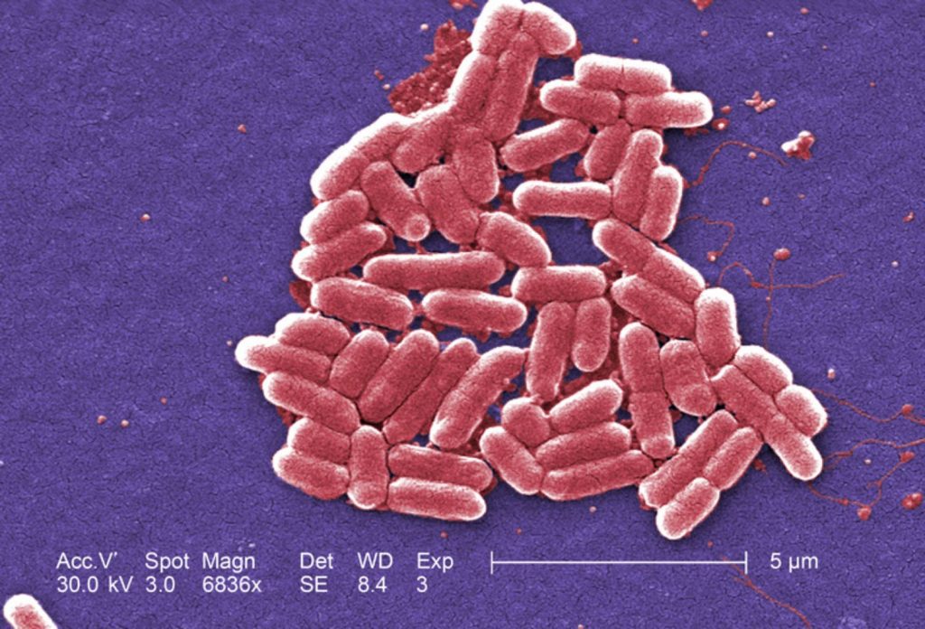 اشریشیا کلای (Escherichia coli)، باکتری گرم-منفی از سردۀ اشریشیا که به وفور در رودۀ تحتانی جانورات خون‌گرم یافت می‌شود. امتیاز تصویر: CDC