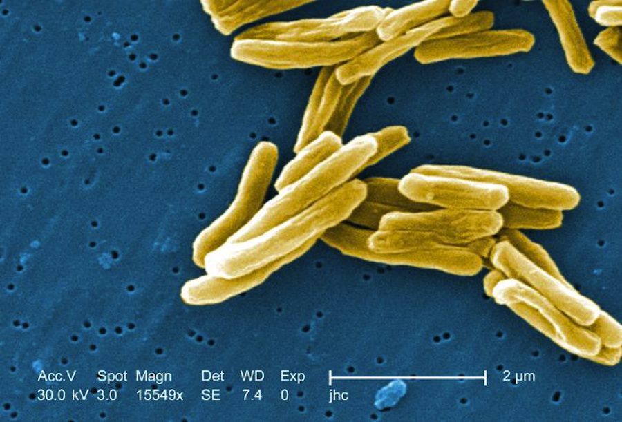 نگارۀ SEM که سویۀ گرم-مثبت از باکتری Mycobacterium tuberculosis را نشان می‌دهد. امتیاز تصویر: Janice Carr, Centers for Disease Control and Prevention