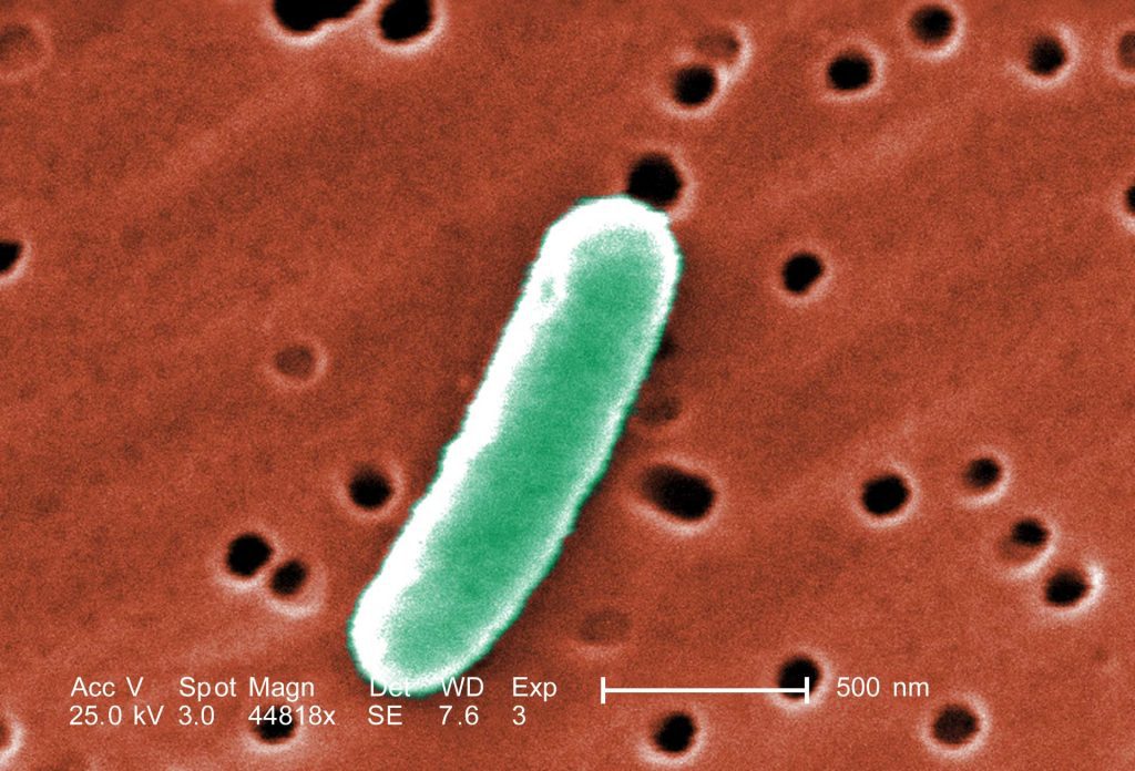 این نگارۀ SEM، با بزرگ‌نمایی بسیار بالای ۴۴۸۱۸x بخشی از خصوصیات مورفولوژیک E. coli را نشان می‌دهد. امتیاز تصویر: Janice Haney Carr / CDC.