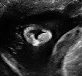 virtualdr.ir/pregnancy week 25 ultrasound