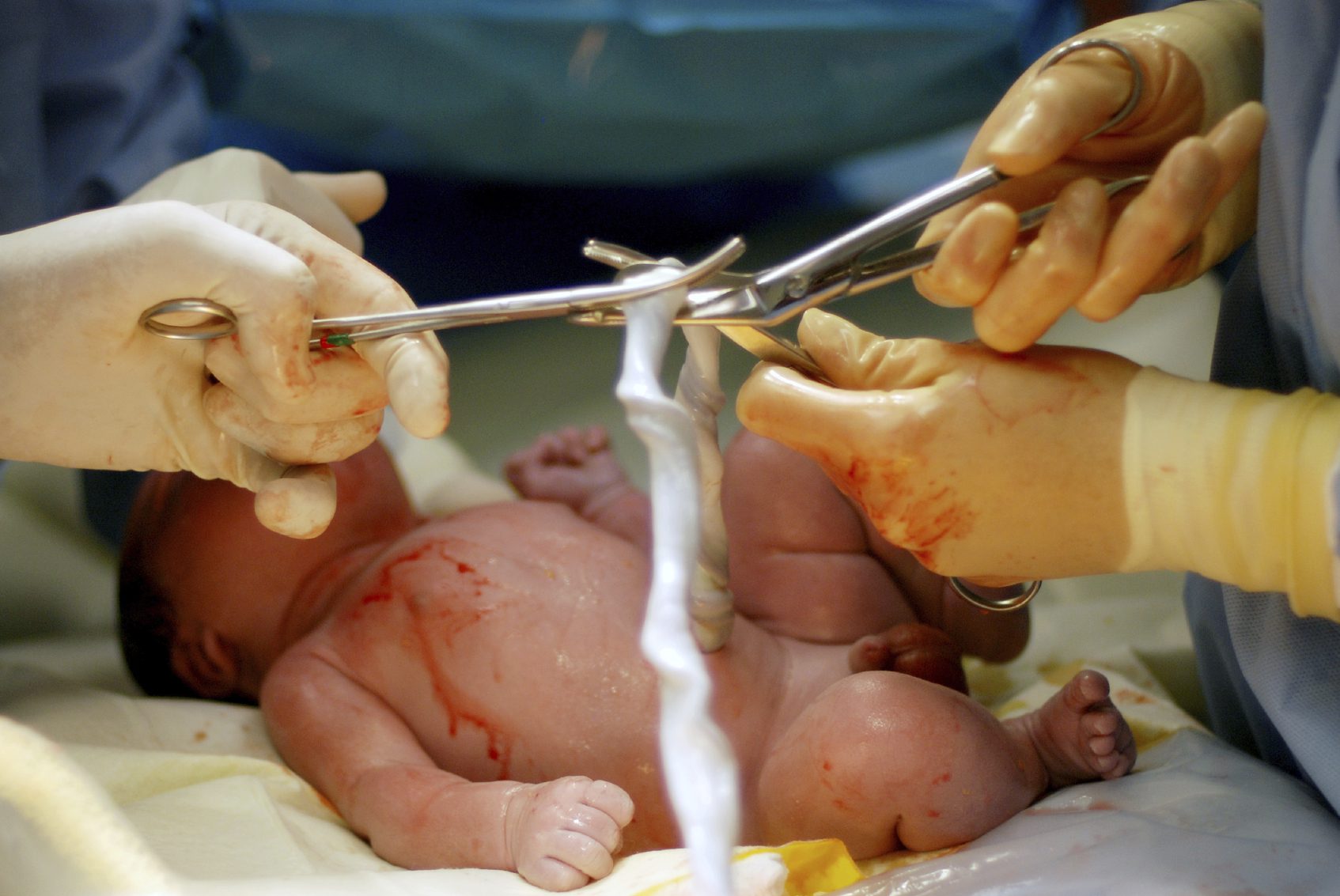 virtualdr.ir/umblical cord clamping