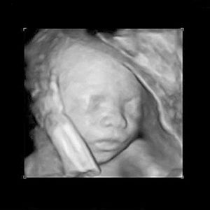 virtualdr.ir/pregnancy week 17 ultrasound