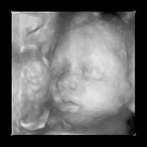 virtualdr.ir/pregnancy week 26 ultrasound