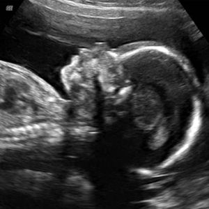 virtualdr.ir/pregnancy week 21 ultrasound