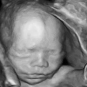 virtualdr.ir/pregnancy week 22 ultrasound
