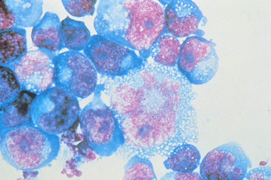 تصویر نمونه‌ای از سلول‌هایی که به عنوان مخازن ویروس HIV عمل می‌کنند