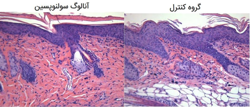 تصاویر فوق مقاطعی از پوست در مدل حیوانی بیماری پسوریازیس می‌باشد که سمت چپ با آنالوگ سولنوپسین تحت درمان قرار گرفته و سمت راست نمایانگر گروه شاهد است که با کرم معمولی کنترل شده است.