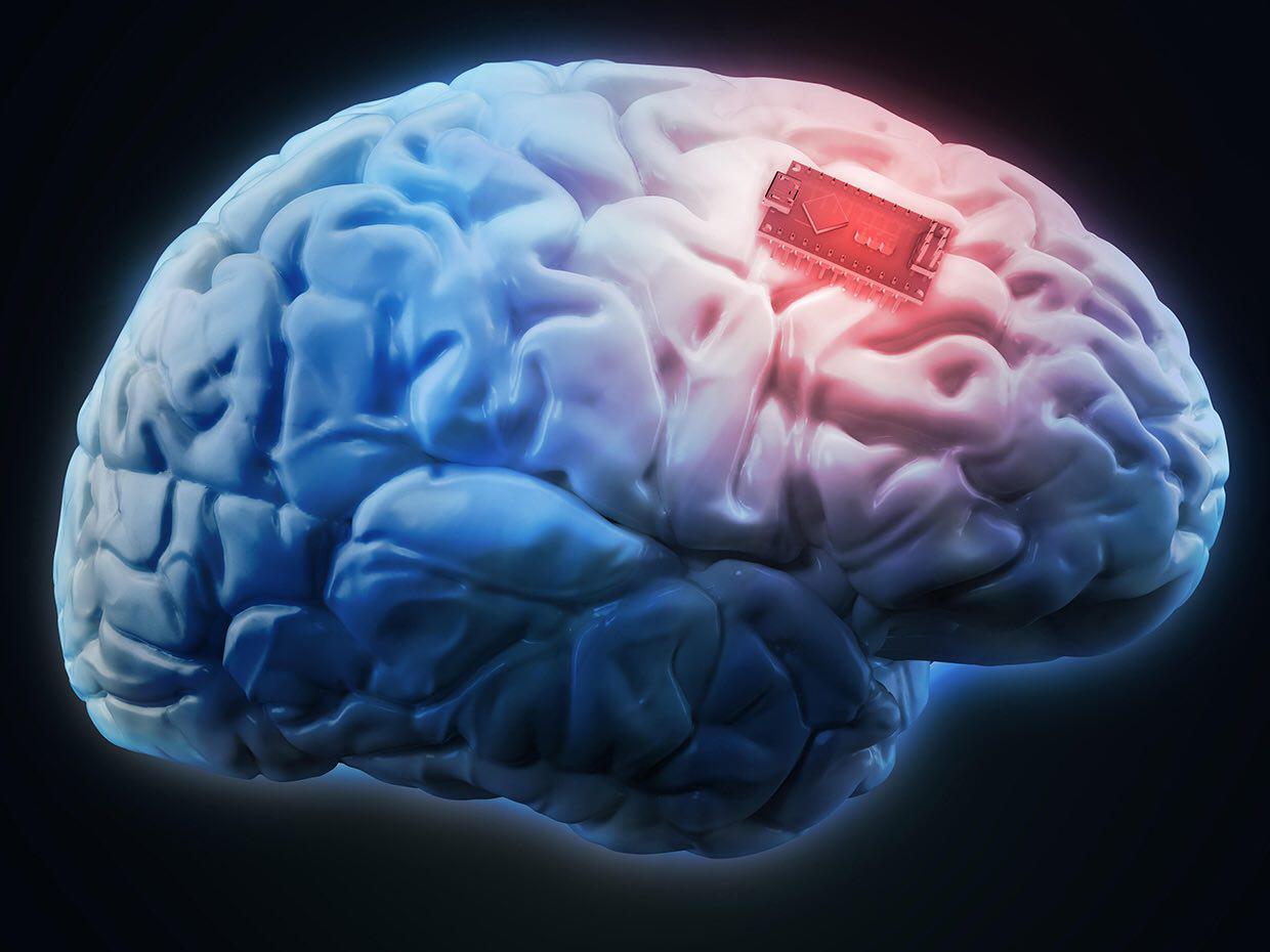 افزایش حافظه به کمک ایمپلنت مغزی