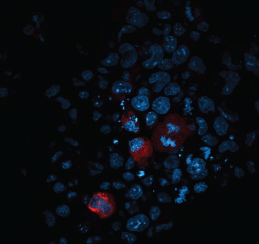 سلول‌های بنیادی رویانی طوری تغییر داده‌ شده‌اند که نبود متیلاسیون DNA به ترانسپوزون‌ها اجازه دهد تا فعال شوند (DNA با رنگ‌ آبی نشان داده شده است). سلول‌هایی که حاوی ترانسپوزون‌های فعال اند به رنگ قرمز دیده می‌شود. Rebecca Berrens©
