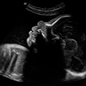 virtualdr.ir/pregnancy week 29 ultrasound