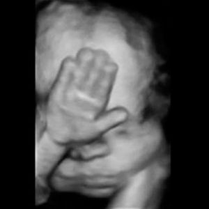 virtualdr.ir/pregnancy week 30 ultrasound