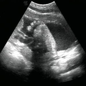 سونوگرافی جنین هفته سی و دوم