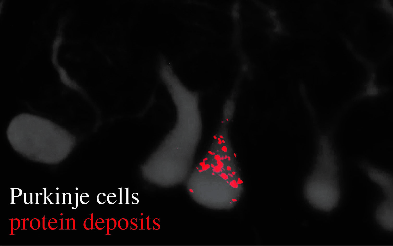 purkinje cells protein deposits