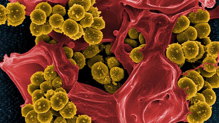 عامل ضدمیکروبی جدیدی توانسته سویه‌های استافیلوکوکوس اورئوس مقاوم به متی‌سیلین (MRSA) را نابود کند. (NIAID_Flickr/wikimedia commons (CC BY 2.0))