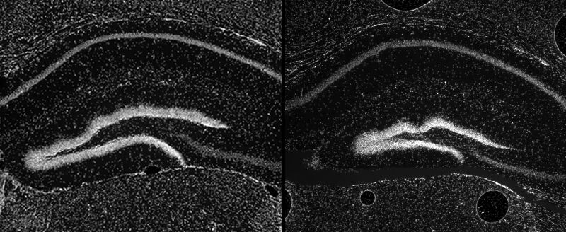 قسمتی از مغز پیشین موش نرمال (چپ) و جهش‌یافته (راست) (D. Dickel et al)