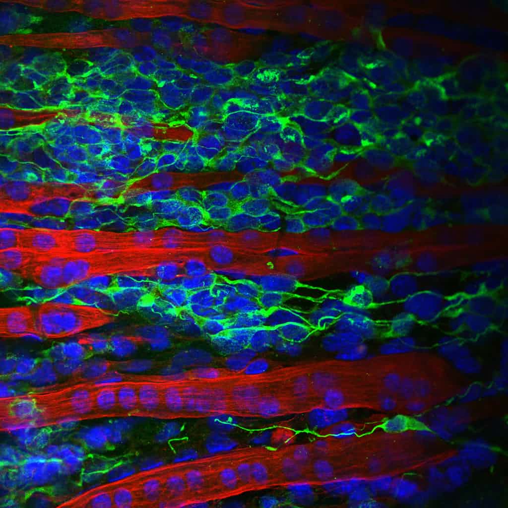مدل بافتی مهندسی‌شده‌ی سه بعدی از پیوستگاه عصبی-عضلانی (NMJ) که اجازه می‌دهد به جای مدل‌های جانوری، روی مدل‌های نزدیک به انسان مطالعات صورت گیرد. دکتر Andrew Capel از دانشگاه Loughborough. رشته‎های قرمز فیبرهای عضلانی و نواحی سبز، نورون‌ها را نشان می‌دهند.