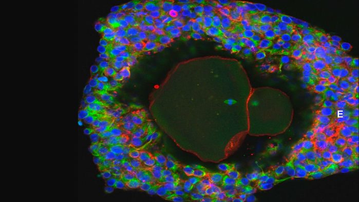 تحقیق آزمایشگاهی جدیدی موفق به تولید تخمک (بالا) از سلول‌های نابالغ تخمدانی شد. (David Albertini)
