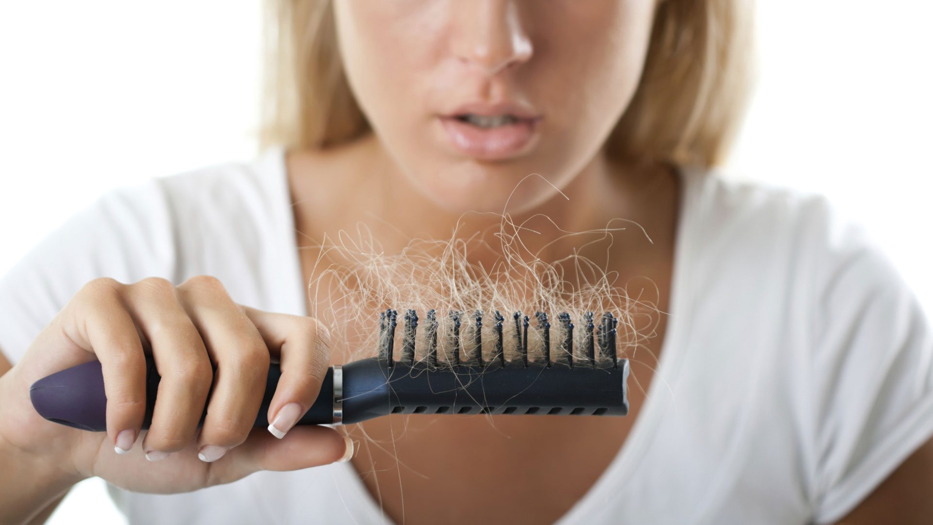 دلیل ریزش مو در افراد بالغ شده بعد از سال 2000 چیست؟