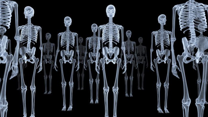 روش جدید تصویربرداری اشعه‌ی ایکس با دوز یک میلیون برابر کمتر، دستاورد بزرگی خواهد بود. 