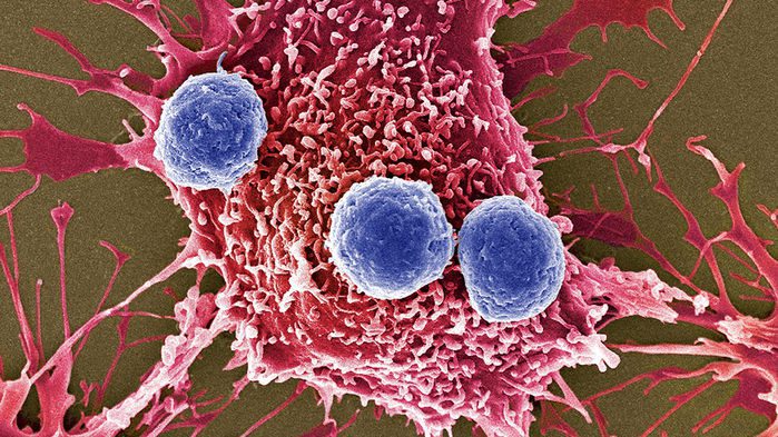کلاس دارویی که با فعال کردن سلول‌های T به جنگ سرطان می‌رود، نتوانست کارایی خود را اثبات کند. STEVE GSCHMEISSNER/SCIENCE SOURCE
