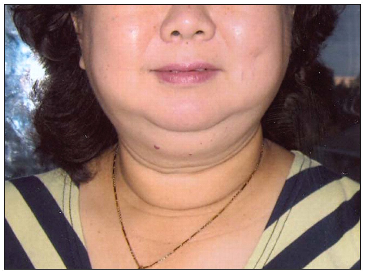 سندرم کوشینگ دکتر مجازی