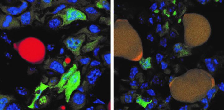 تصویر بالا این پروسه را نشان می‌دهد، سلول‌های سرطانی با یک پروتئین فلوئورسنت سبز و سلول‌های نرمال چربی با رنگ قرمز در چپ نشان داده شده‌اند. سلول‌های سرطانی تبدیل شده به چربی به رنگ قهوه‌ای (در سمت راست) دیده می‌شود؛ چون قرمزی سلول‌های چربی با سبزی پروتئین سلول‌های سرطانی ترکیب شده است.