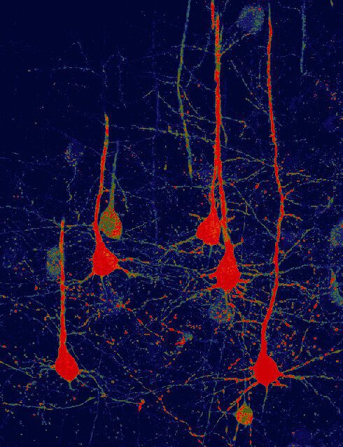 نورون‌های تولید شده از سلول گلیال در ژن‌درمانی 